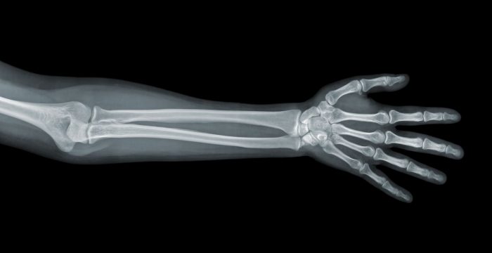 14237544 - hand x-ray view on a black background