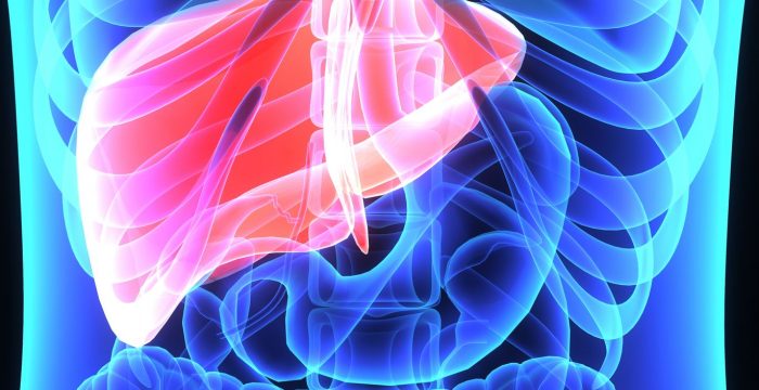 33982513 - liver